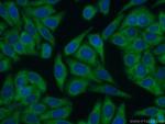 EHHADH Antibody in Immunocytochemistry (ICC/IF)