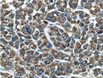 EHHADH Antibody in Immunohistochemistry (Paraffin) (IHC (P))