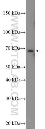 EHHADH Antibody in Western Blot (WB)