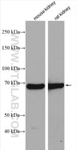 EHHADH Antibody in Western Blot (WB)