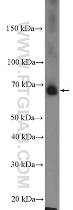 EHHADH Antibody in Western Blot (WB)