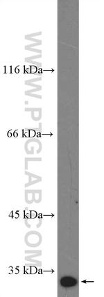 FAM84A Antibody in Western Blot (WB)