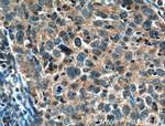 MMP1 Antibody in Immunohistochemistry (Paraffin) (IHC (P))