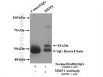MMP1 Antibody in Immunoprecipitation (IP)