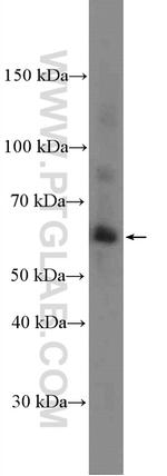 MMP1 Antibody in Western Blot (WB)