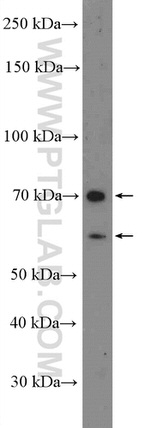 MMP1 Antibody in Western Blot (WB)