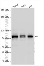 MTHFR Antibody in Western Blot (WB)