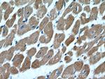 Cardiac Troponin T Antibody in Immunohistochemistry (Paraffin) (IHC (P))