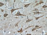SIRPD Antibody in Immunohistochemistry (Paraffin) (IHC (P))