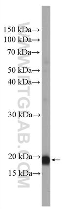 SIRPD Antibody in Western Blot (WB)