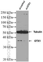 OTX1 Antibody in Western Blot (WB)