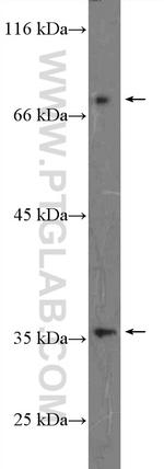 EPB41L4A Antibody in Western Blot (WB)