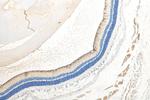CRB1 Antibody in Immunohistochemistry (Paraffin) (IHC (P))