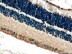 CRB1 Antibody in Immunohistochemistry (Paraffin) (IHC (P))