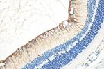 CRB1 Antibody in Immunohistochemistry (Paraffin) (IHC (P))