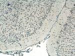 CRB1 Antibody in Immunohistochemistry (Paraffin) (IHC (P))