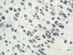 CRB1 Antibody in Immunohistochemistry (Paraffin) (IHC (P))
