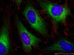 ELOVL5 Antibody in Immunocytochemistry (ICC/IF)