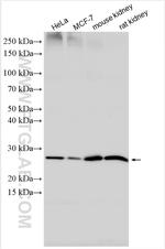 ELOVL5 Antibody in Western Blot (WB)