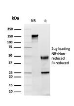 GDF8 (Growth Differentiation Factor 8)/Myostatin Monoclonal Antibody (GDF9/4261)
