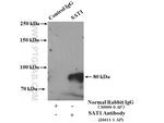 SAT1 Antibody in Immunoprecipitation (IP)