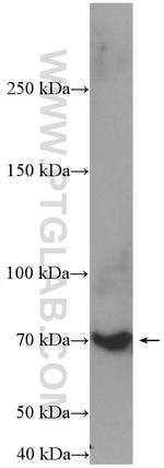 SAT1 Antibody in Western Blot (WB)