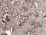 SMARCA2 Antibody in Immunohistochemistry (Paraffin) (IHC (P))