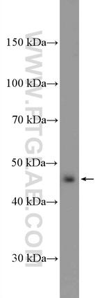 ALDH9A1 Antibody in Western Blot (WB)