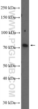 CATSPERB Antibody in Western Blot (WB)