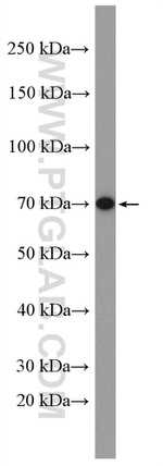 CATSPERB Antibody in Western Blot (WB)