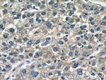AADAC Antibody in Immunohistochemistry (Paraffin) (IHC (P))