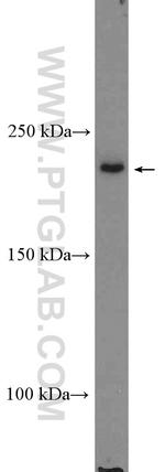 HELZ Antibody in Western Blot (WB)