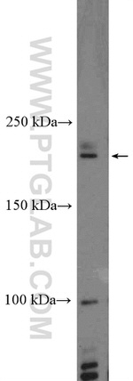 HELZ Antibody in Western Blot (WB)