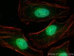 JMJD1C Antibody in Immunocytochemistry (ICC/IF)