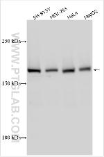 JMJD1C Antibody in Western Blot (WB)