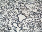 TIMP2 Antibody in Immunohistochemistry (Paraffin) (IHC (P))