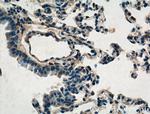 TIMP2 Antibody in Immunohistochemistry (Paraffin) (IHC (P))