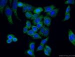 REEP4 Antibody in Immunocytochemistry (ICC/IF)