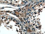 REEP4 Antibody in Immunohistochemistry (Paraffin) (IHC (P))