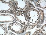 REEP4 Antibody in Immunohistochemistry (Paraffin) (IHC (P))
