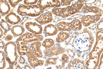 ADAMTSL3 Antibody in Immunohistochemistry (Paraffin) (IHC (P))
