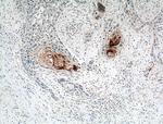 S100A7/Psoriasin Antibody in Immunohistochemistry (Paraffin) (IHC (P))