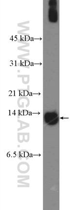 S100A7/Psoriasin Antibody in Western Blot (WB)