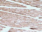 Calsequestrin Antibody in Immunohistochemistry (Paraffin) (IHC (P))