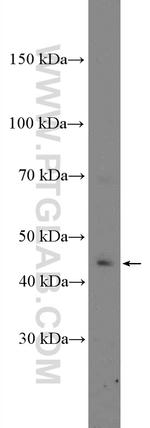 Calsequestrin Antibody in Western Blot (WB)