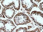 MAEL Antibody in Immunohistochemistry (Paraffin) (IHC (P))