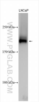 CACNA2D4 Antibody in Western Blot (WB)
