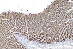 INPPL1 Antibody in Immunohistochemistry (Paraffin) (IHC (P))