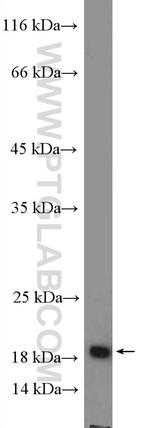 SSPN Antibody in Western Blot (WB)