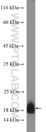 SSPN Antibody in Western Blot (WB)